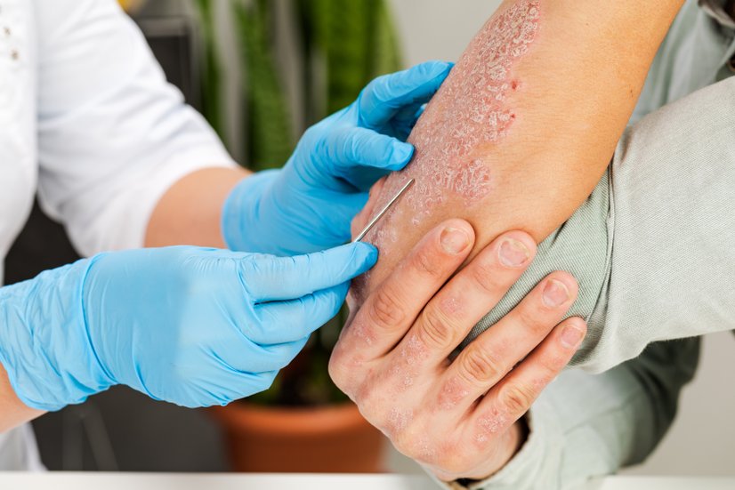 Diagnostik: Untersuchung einer Dermatitis