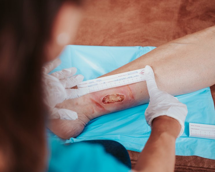 Wunddokumentation nach dem GREIS-Modell