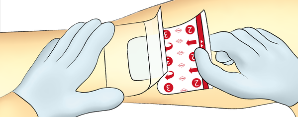 Dracofix Iermull Waterproof GA Schritt 3