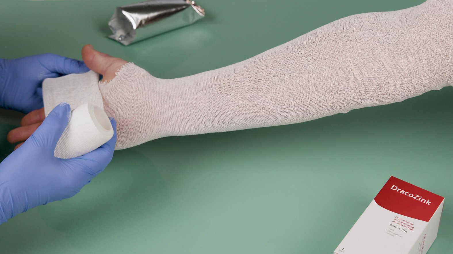 Zinkleimverband DracoZink wird auf Schlauchverband appliziert