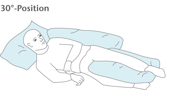 30°-Positionierung zur Dekubitusprophylaxe
