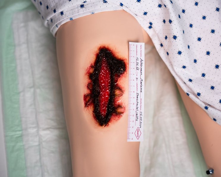 Wundassessment: Medizinische Diagnostik und Wundbeurteilung