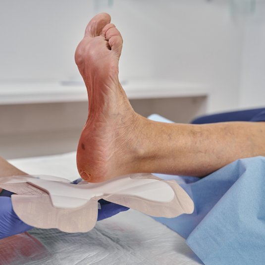 DracoFoam Ferse haft Anwendung