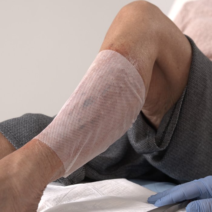 DracoTüll Silikon 20x20cm, Anwendung