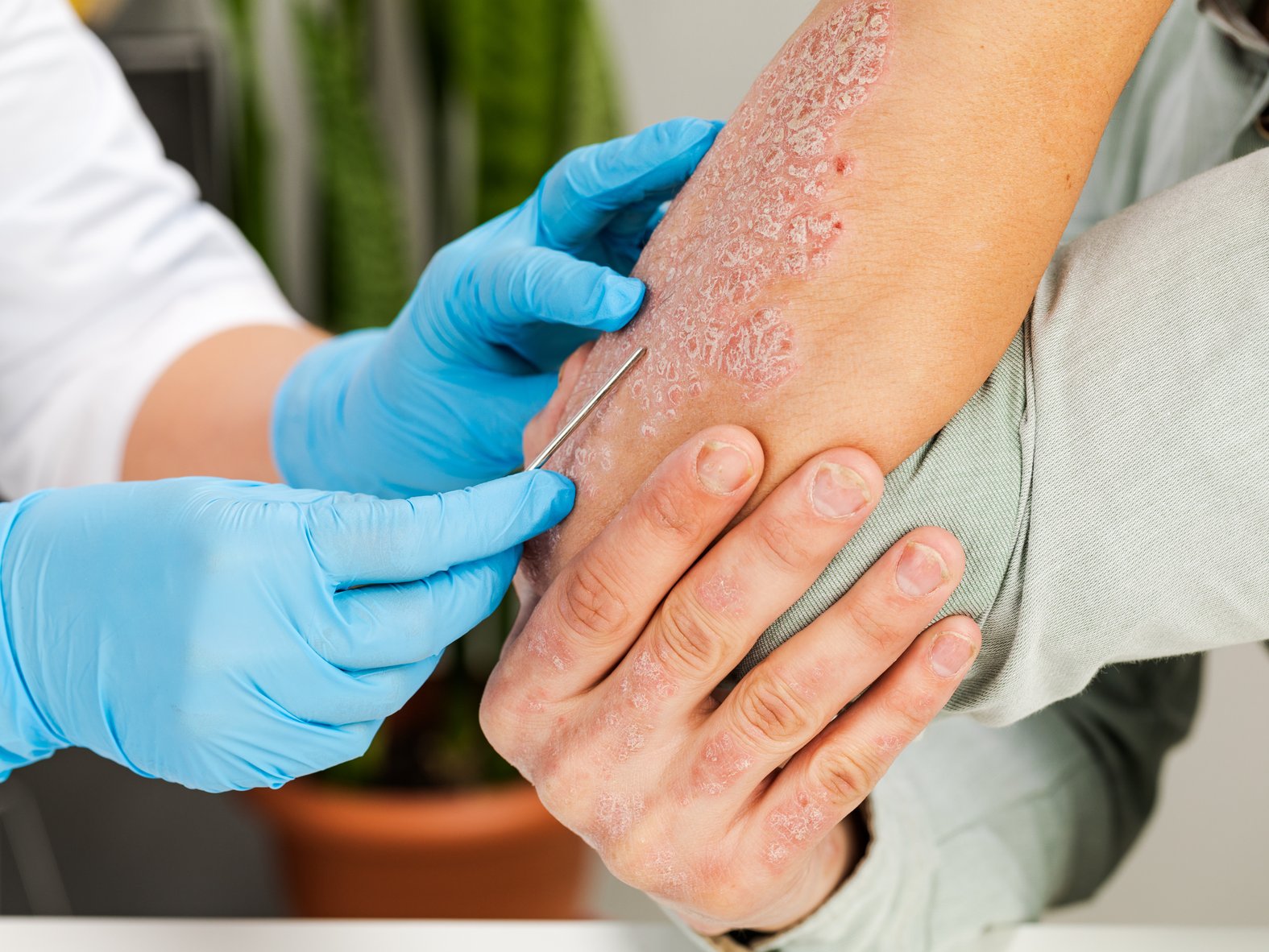Diagnostik: Untersuchung einer Dermatitis