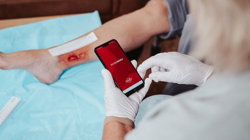 Draco Teaser WundDoku App