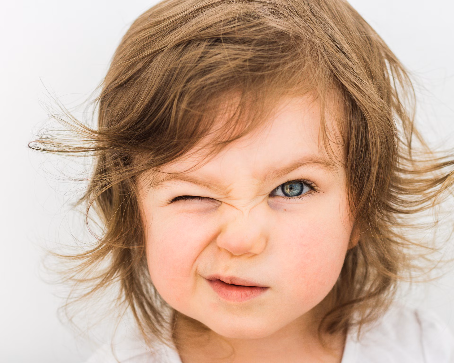 Kind mit Anisometropie kneift ein Auge zu