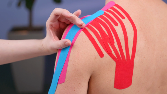 Kinesiologisches Taping – Anlagetechniken am Oberkörper