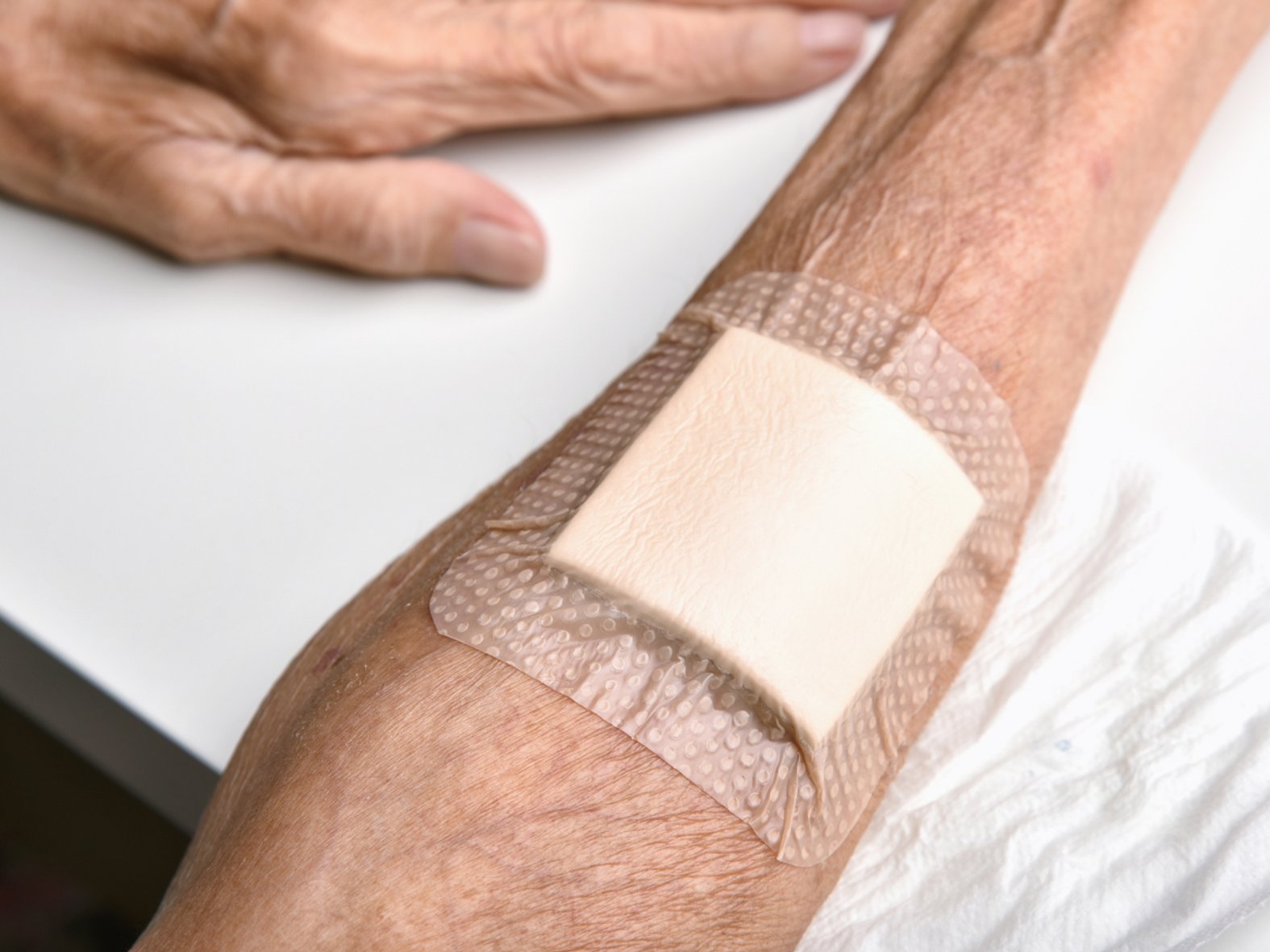 Klebendes Pflaster auf Altershaut, Gefahr von MARSI