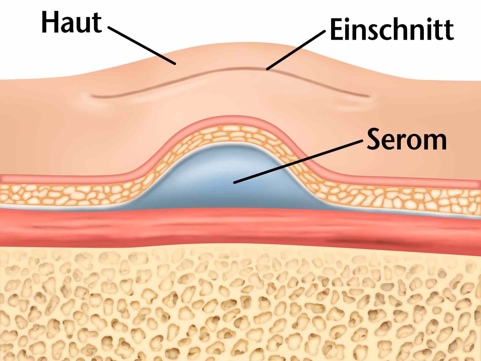 Serom Grafik