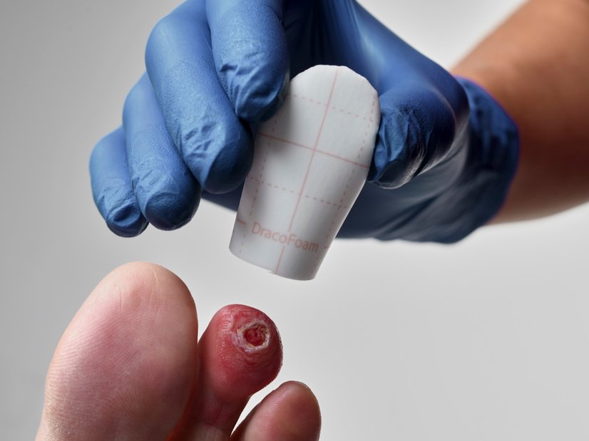 DracoFoam Zehenkappe, Anwendung Zehenverband
