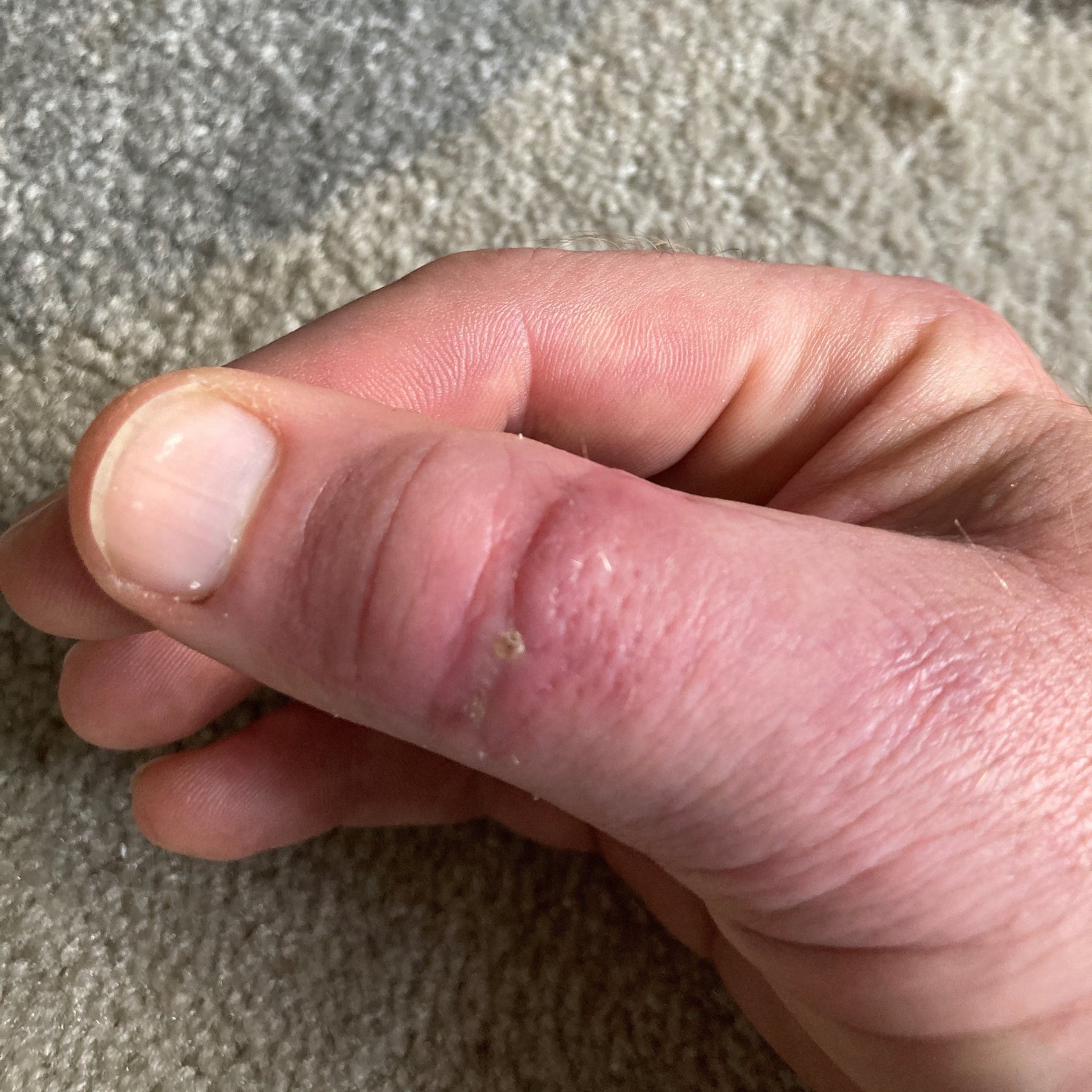 Foto 13: Abgeheilte Schnittwunde