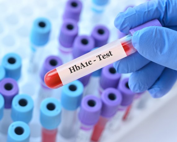 HbA1c und Nüchternblutzucker: Die zwei wichtigsten Werte – und wie ihr sie erklärt