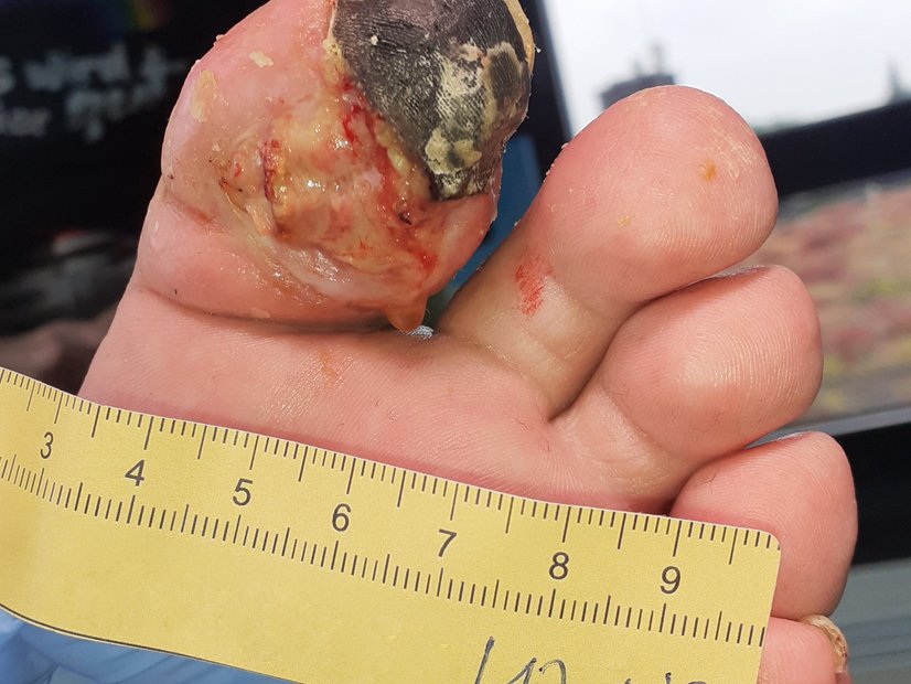 Ausgangssituation der nekrotischen Wunde (Tag 1)