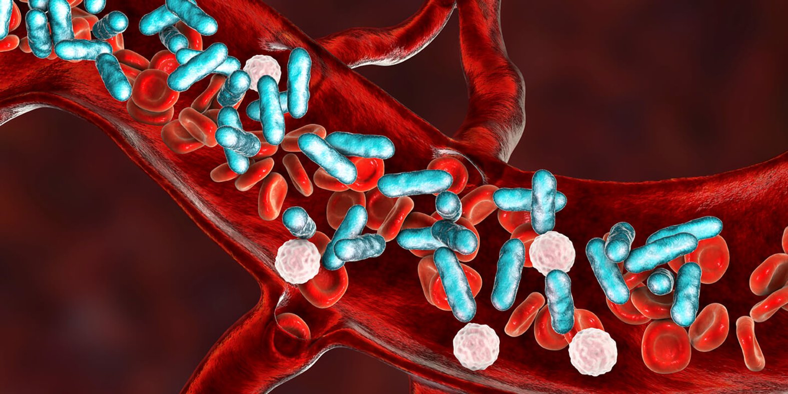 Sepsis: Erreger im Blutkreislauf