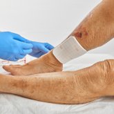 Dracofoam easyfix am Unterschenkel