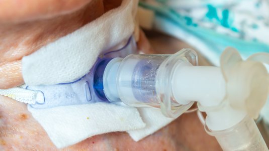 Mehr Sicherheit im Umgang mit Tracheostoma, Teil 1/2