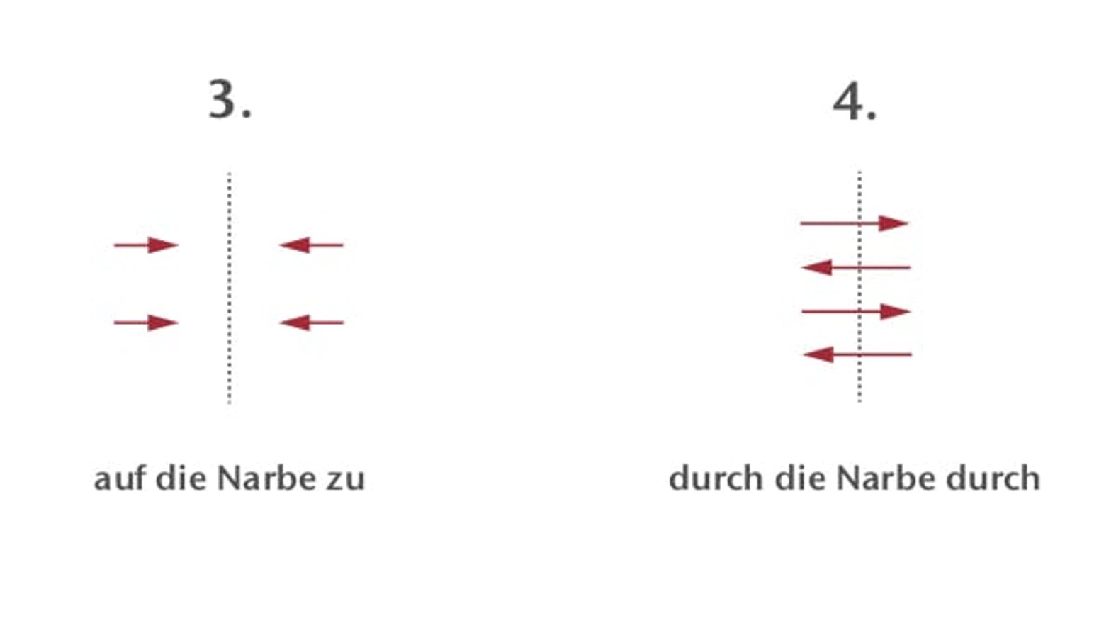 Grafik Narbenmassage: Schritt 3 und 4