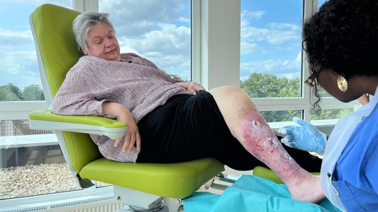 Fallbeispiel – Ulcus cruris venosum – Claudia Untermann