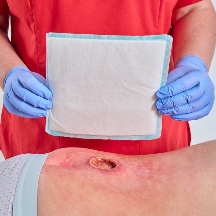 DracoSuperabsorber Anwendung