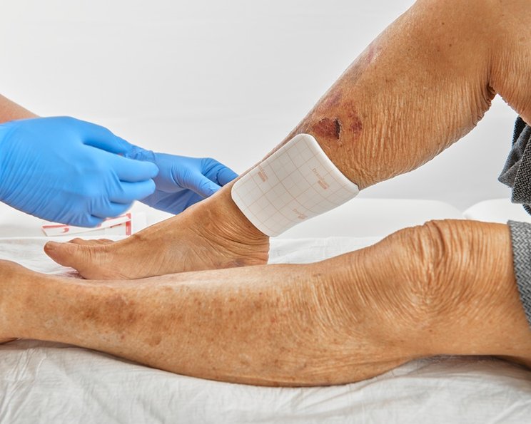 DracoFoam easyfix: Deine “3. Hand” bei der Fixierung!