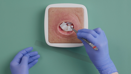 Kurz und kompakt: Versorgung trockener Wunden