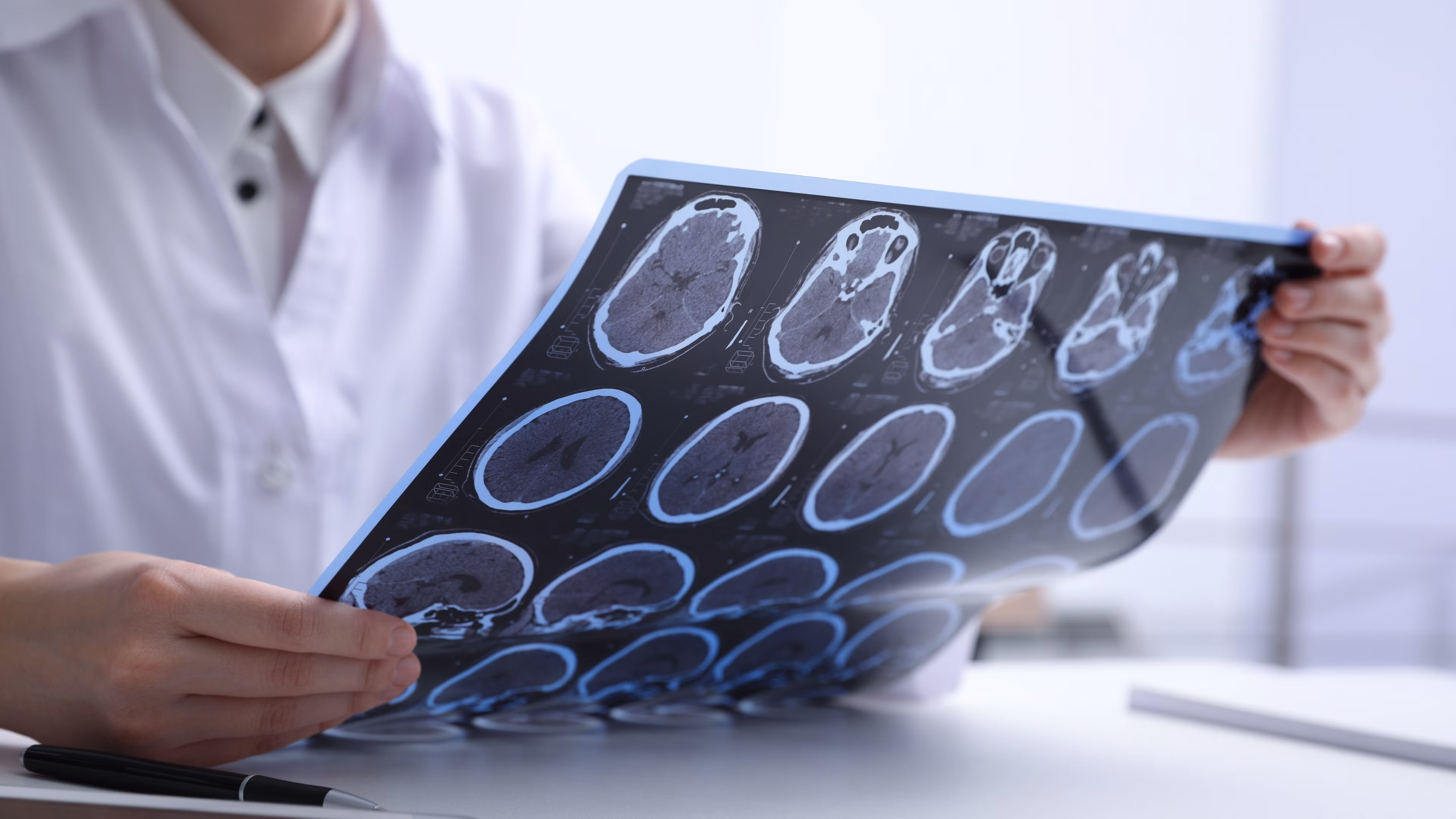 MS – Die vielen Gesichter der Multiplen Sklerose