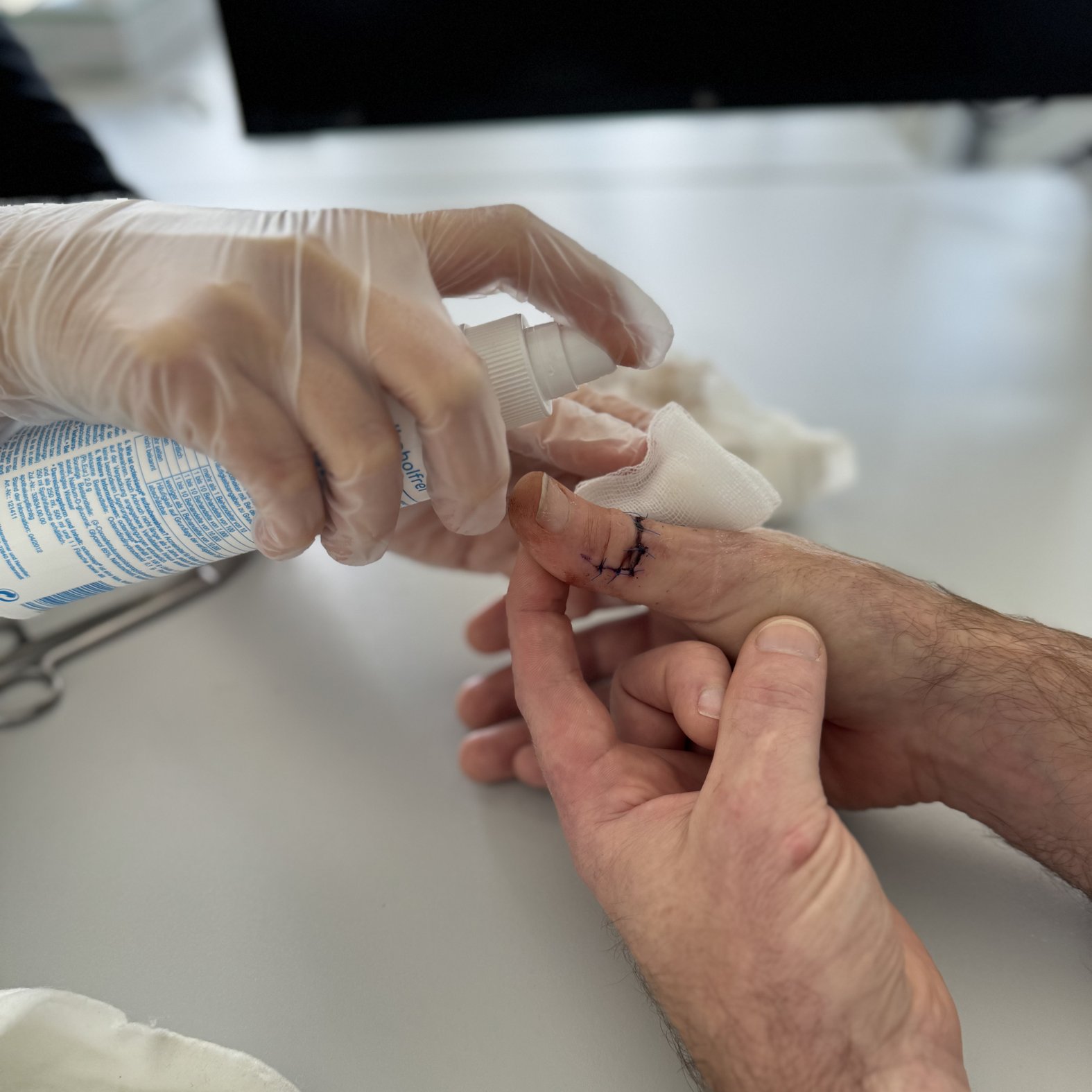 Foto 7: Desinfektion der Wunde während des Verbandwechsels