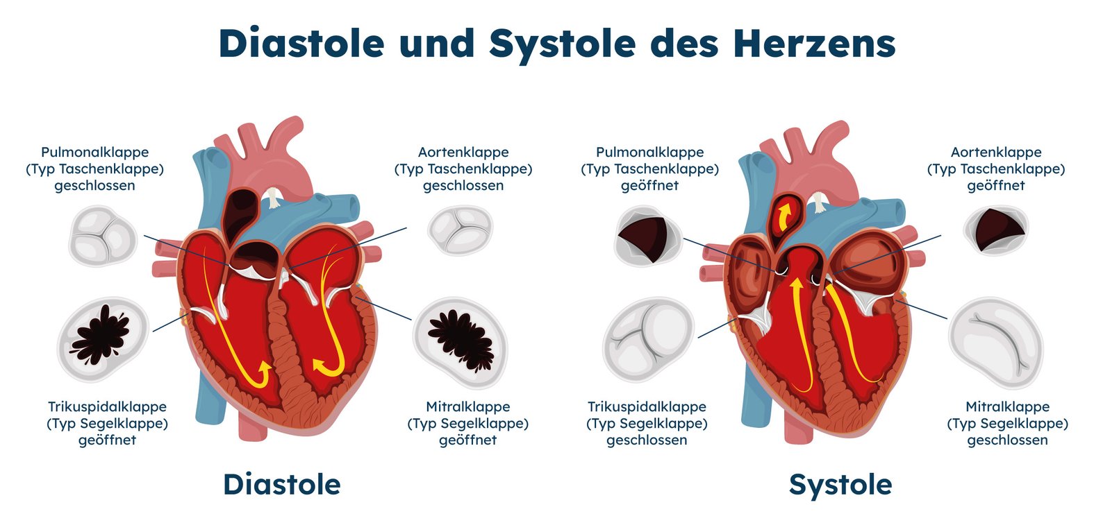 Systole und Diastole des Herzens, Herzklappen, schematische Darstellung