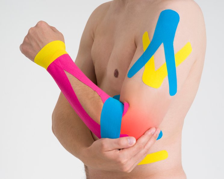 Kinesiologisches Tape: Anwendung, Beratung und Schnittmuster