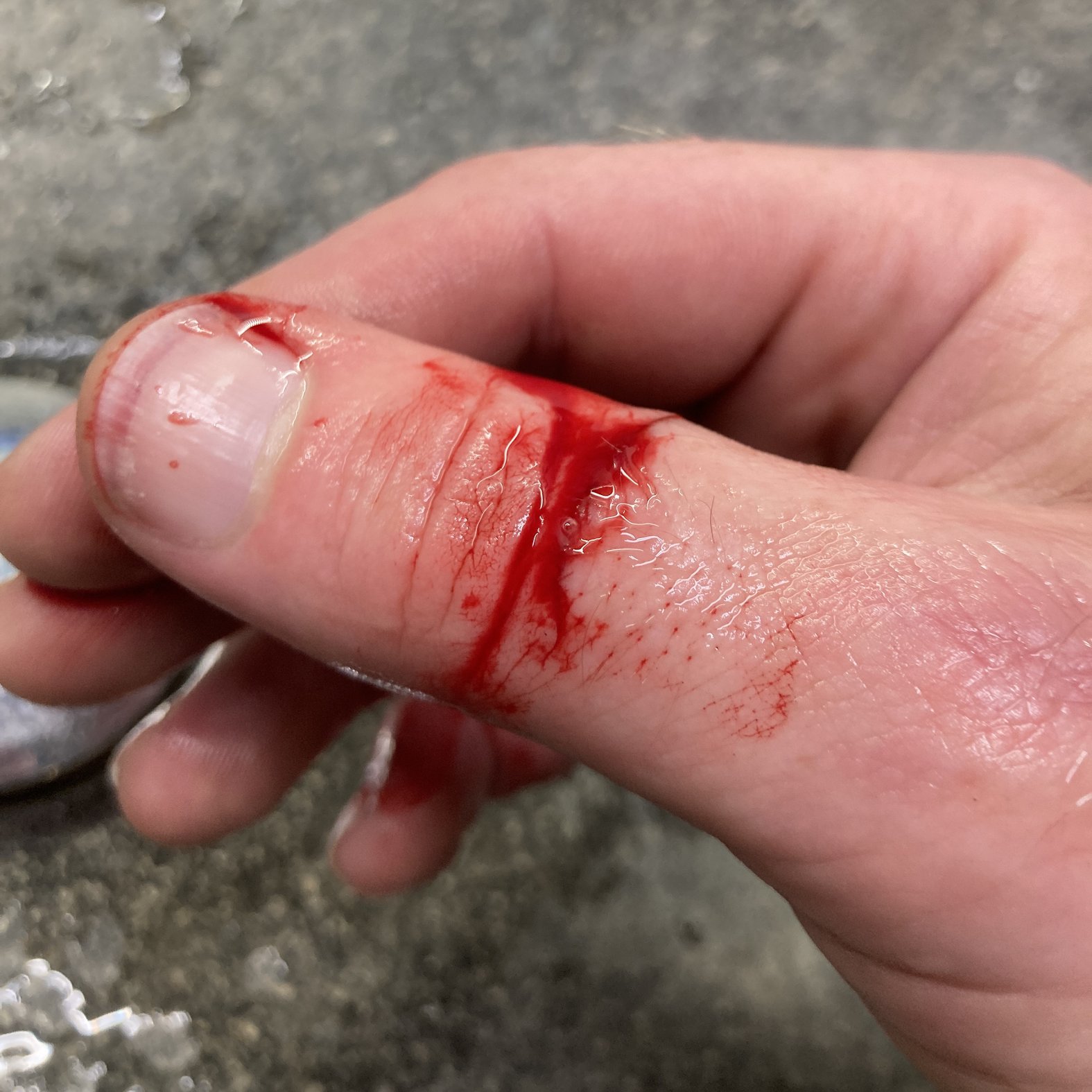 Foto 1: Wunde kurz nach der Entstehung