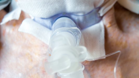 Mehr Sicherheit im Umgang mit Tracheostoma, Teil 2/2