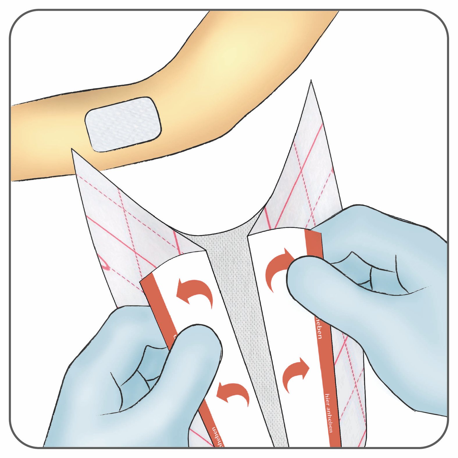 Fixiermull Stretch Anwendung: Anfassen, Schritt 2