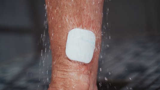 Duschen mit Wunde? Das sollten Sie zur Körperpflege wissen