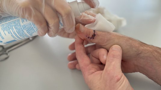 Antiseptika in der Wundversorgung