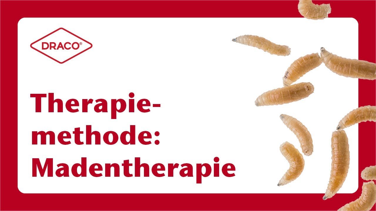 Madentherapie: Biochirurgisches Debridement, Videovorschau