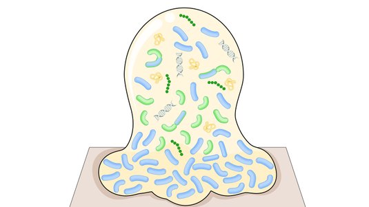 Störenfriede auf der Wunde – Nekrose, Biofilm und Fibrin