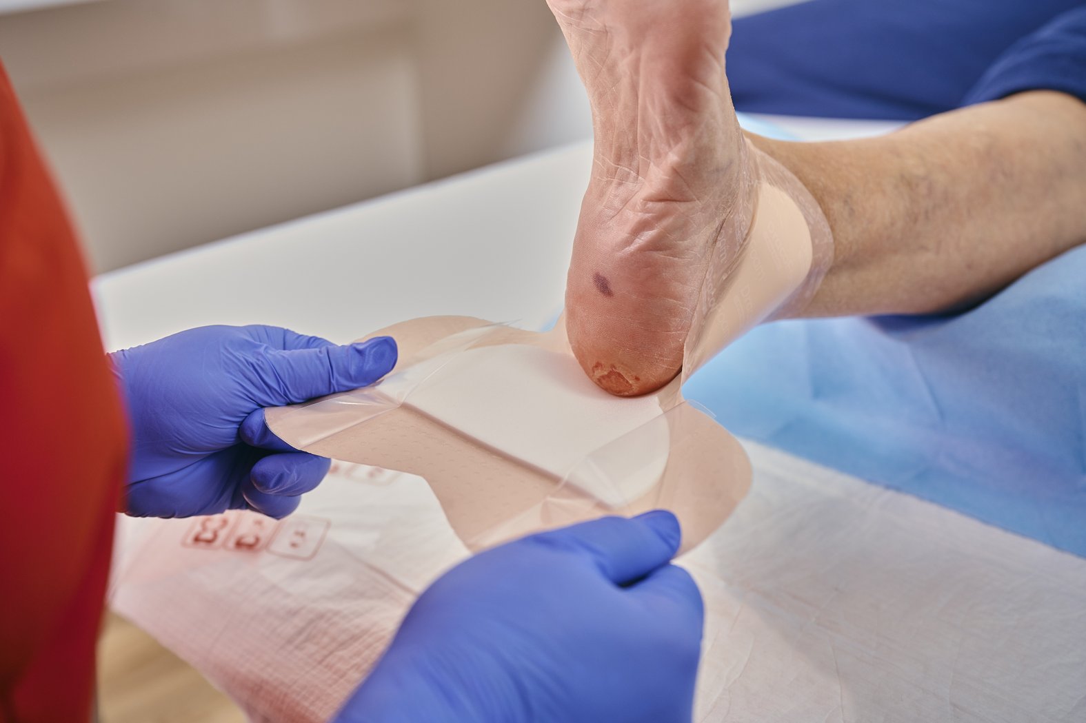 DracoFoam Ferse haft. Wundversorgung eines Fersenulcus