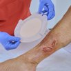 DracoFoam haft sensitiv oval Anwendung
