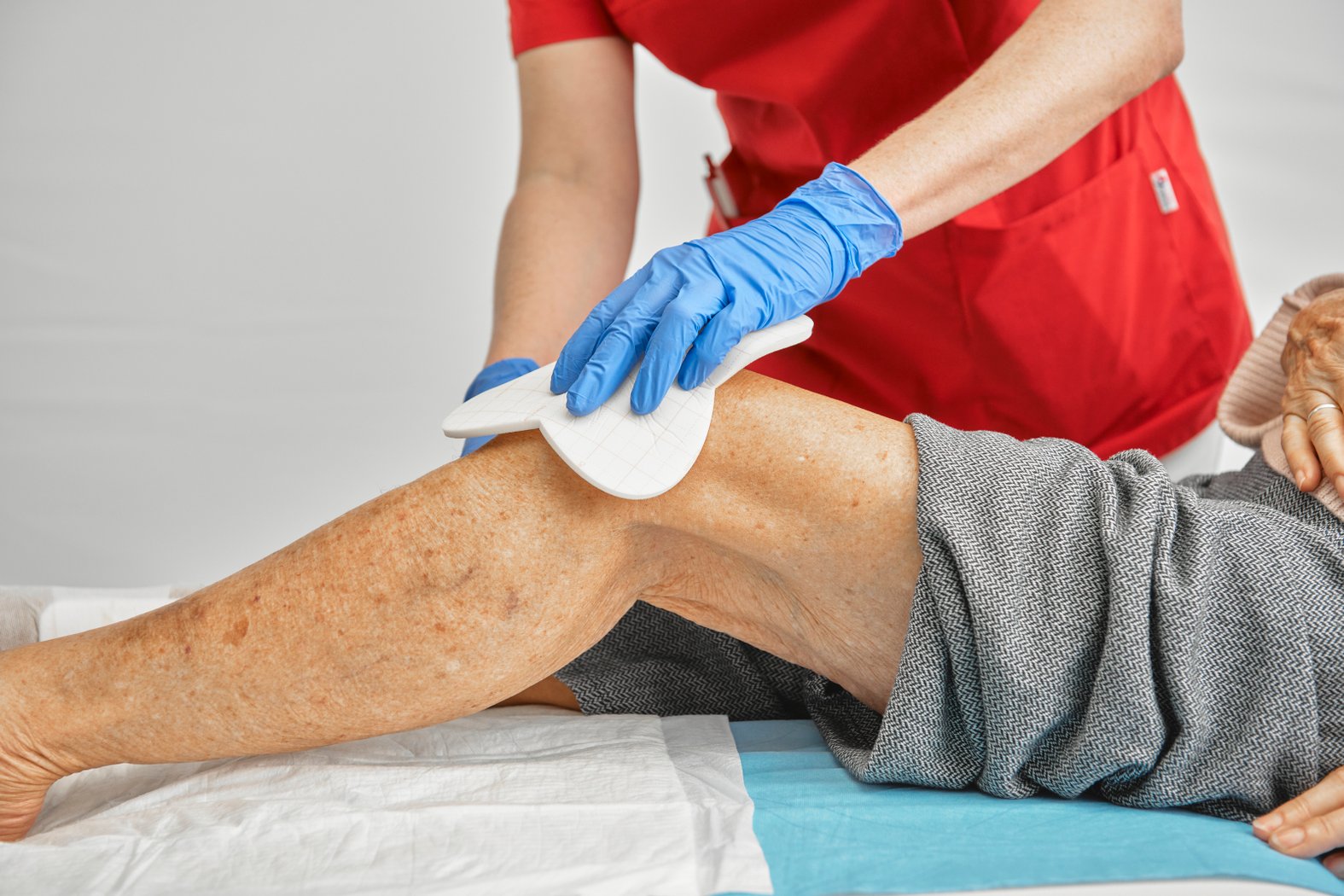 Dracofoam Multishape Schaumstoffwundauflage, Anwendung am Knie